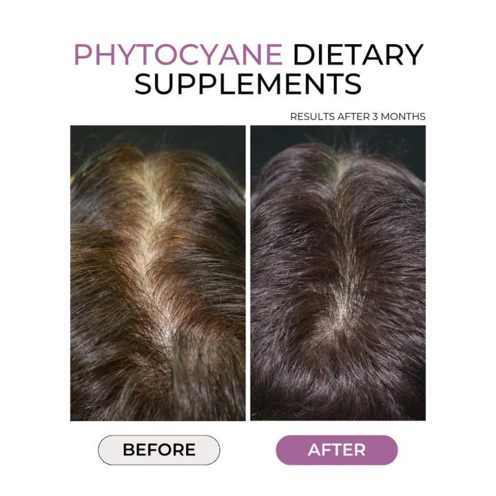 PHYTO Anti Hair Loss Capsules - 84 Capsules